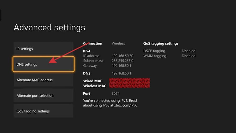 change dns on playstation